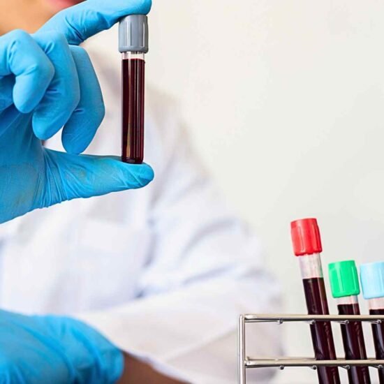Simples exame de sangue revela ‘quanto tempo de vida’ você pode ter